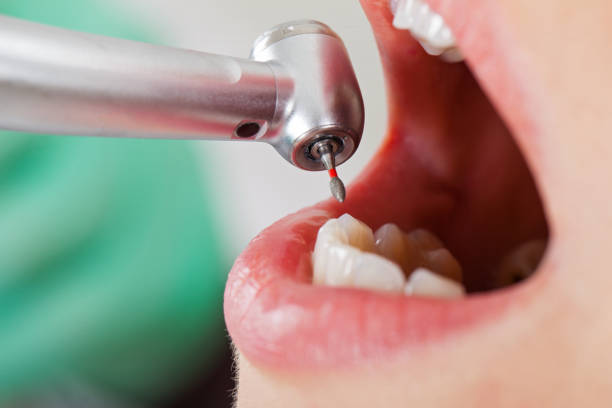Best Broken Tooth Emergency  in Double Springs, AL